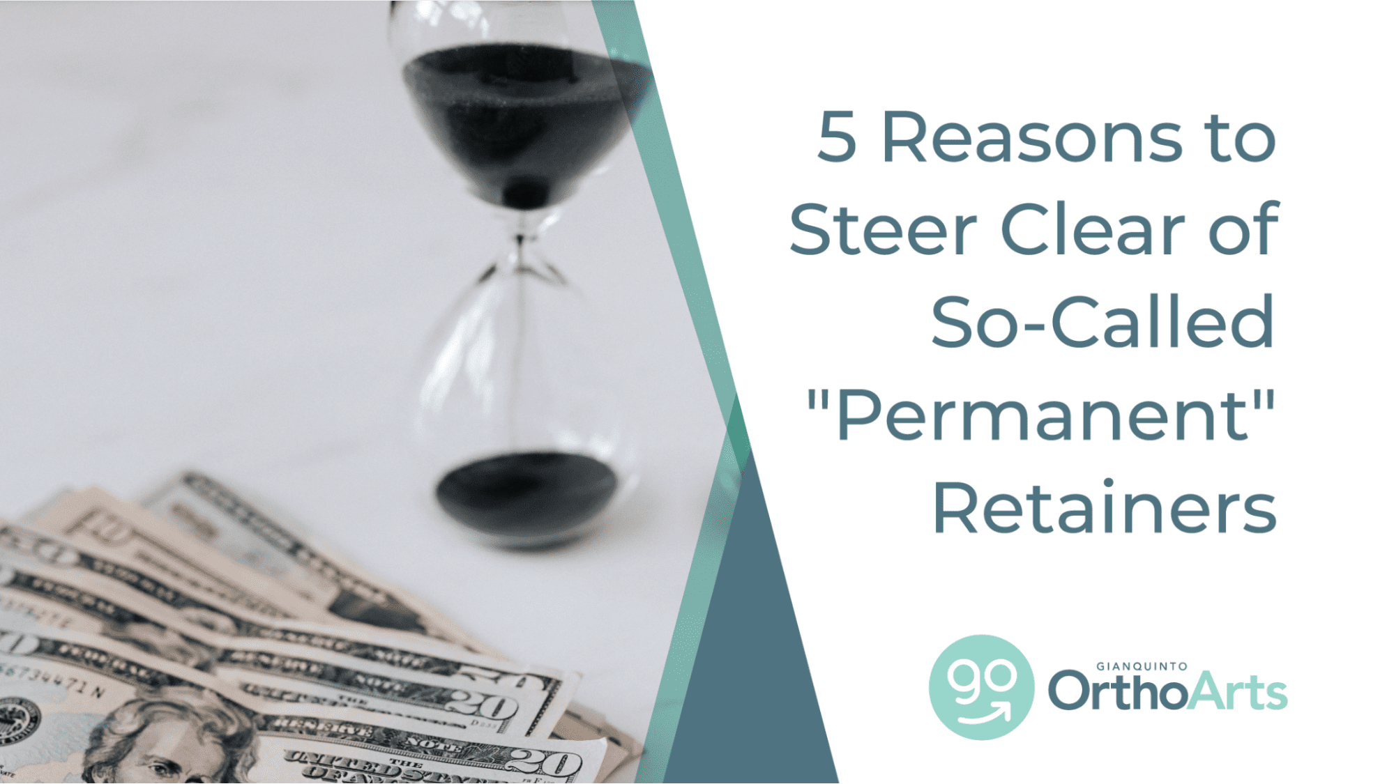 5 Reasons to Steer Clear of So-Called “Permanent” Retainers