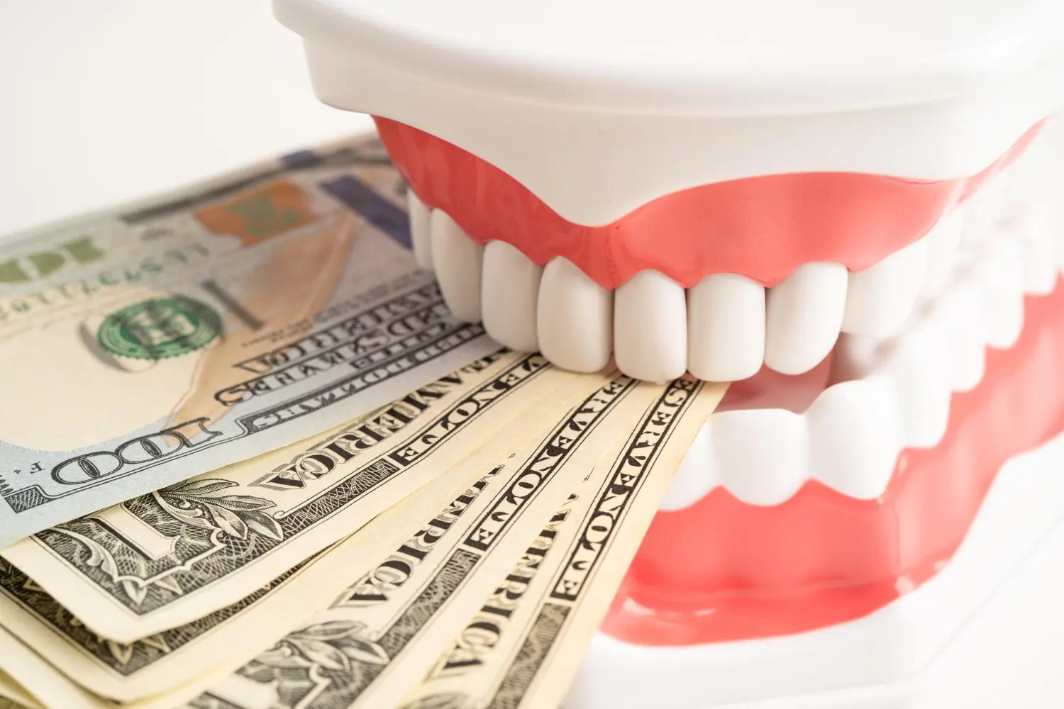 Clear braces on model teeth highlighting Cost and Insurance Coverage for Clear Appliances from Gianquinto Orthodontic Arts in Bakersfield, Tehachapi or Mammoth Lakes, CA