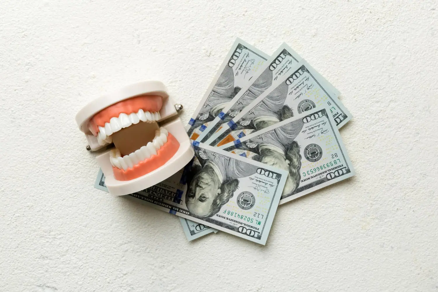 Artificial teeth on $100 bills show flexible Invisalign payment options at Gianquinto Orthodontic Arts in Bakersfield, Tehachapi or Mammoth Lakes, CA
