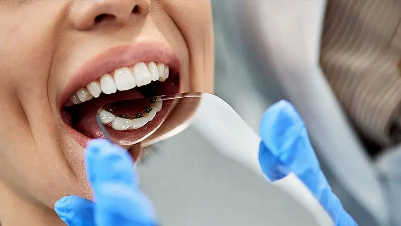 A dentist at examines lingual braces with a dental mirror for adult braces treatment at Gianquinto Orthodontic Arts in Bakersfield, Tehachapi or Mammoth Lakes, CA