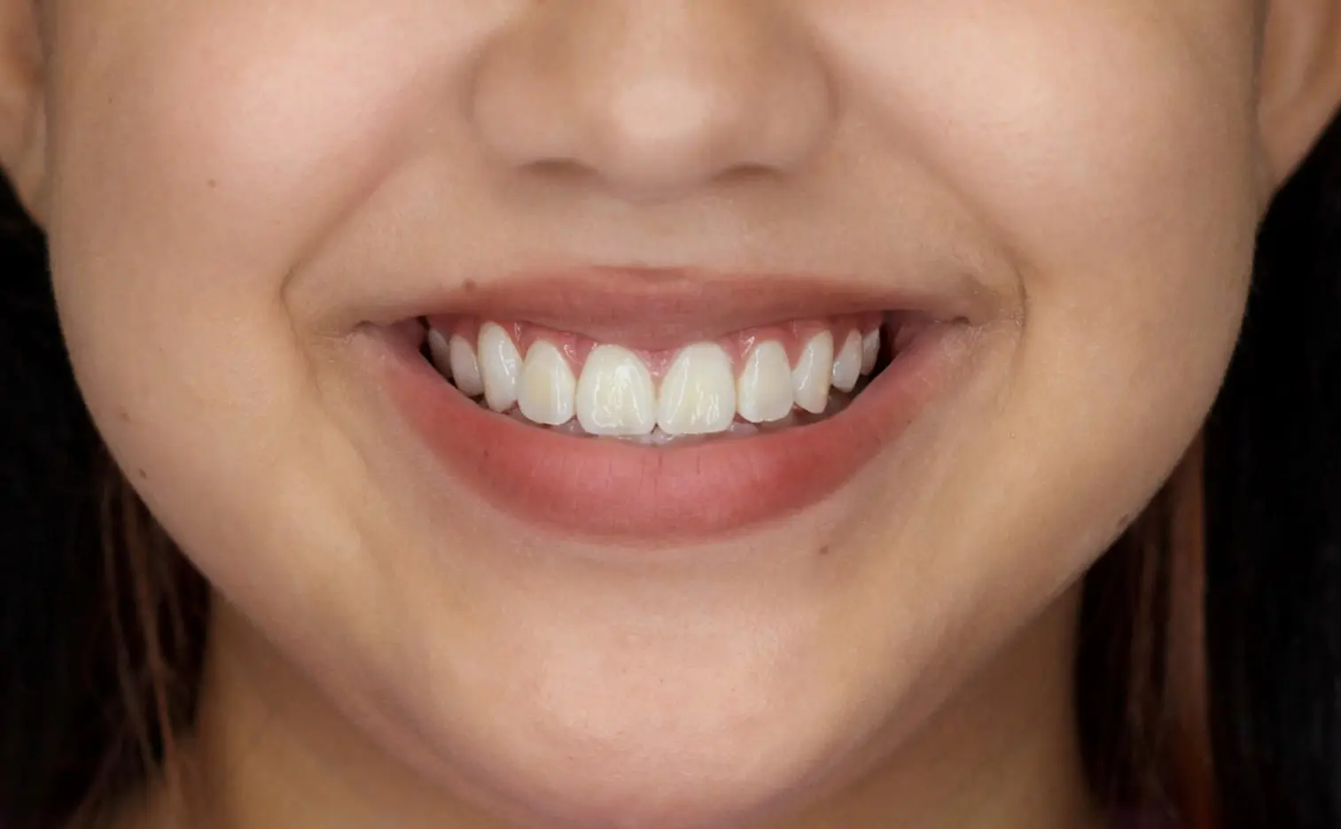 A child smiles perfect for an Gianquinto Orthodontic Arts after-braces photo in Bakersfield, CA.