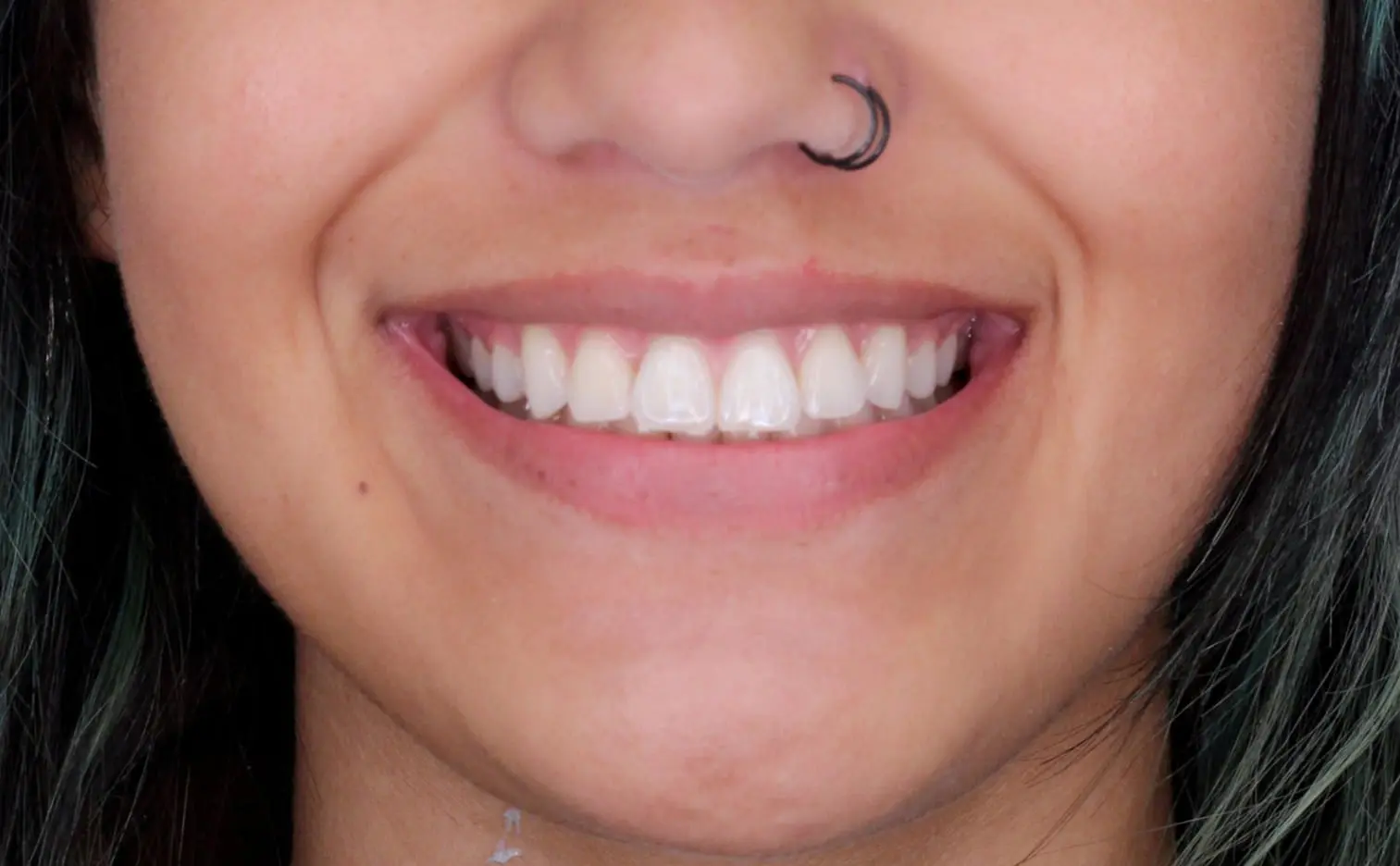 A smiling person shows teeth after braces at Gianquinto Orthodontic Arts in Tehachapi, CA; nose ring visible.