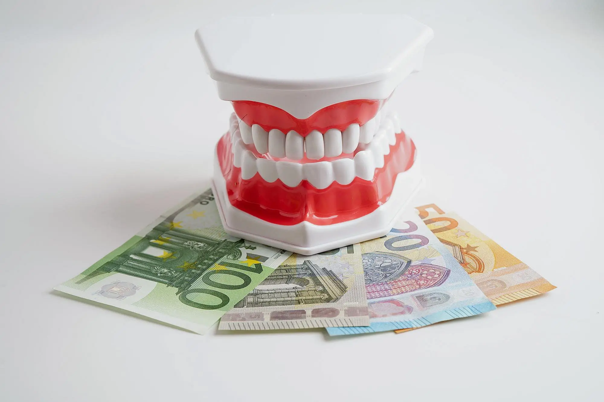 Showcasing Metal Braces Cost, a teeth model sits at Gianquinto Orthodontic Arts in Bakersfield, Tehachapi or Mammoth Lakes, CA