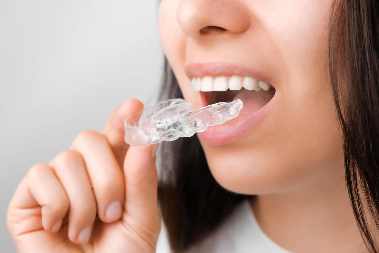 A woman holds a clear aligner, showing the consideration of Invisalign vs Braces at Gianquinto Orthodontic Arts in Bakersfield, Tehachapi or Mammoth Lakes, CA