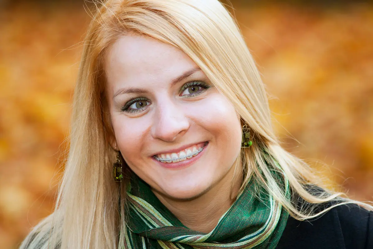 A young woman with ceramic braces from Gianquinto Orthodontic Arts in Bakersfield, CA