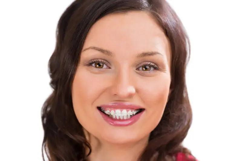 Smiling woman with ceramic braces representing Gianquinto Orthodontic Arts in Tehachapi, CA