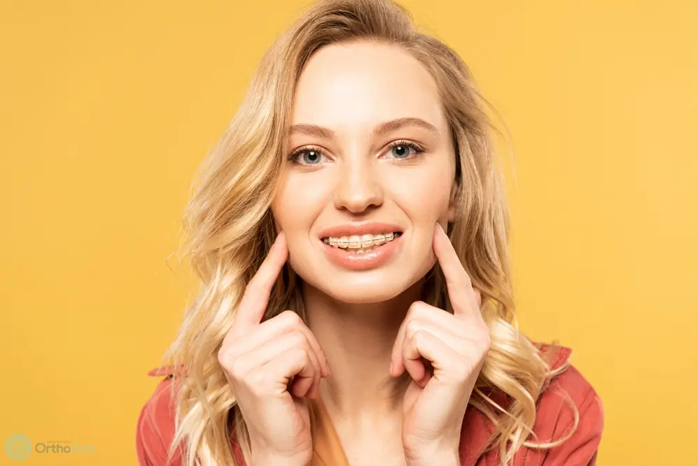 smiling blonde woman clear braces looking camera isolated yellow - How Long Does It Take To Get Used To Braces in Bakersfield, CA 