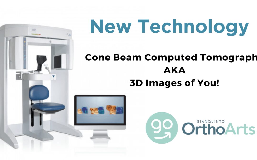 Dr. G Now Offers 3D Cone Beam Imaging!