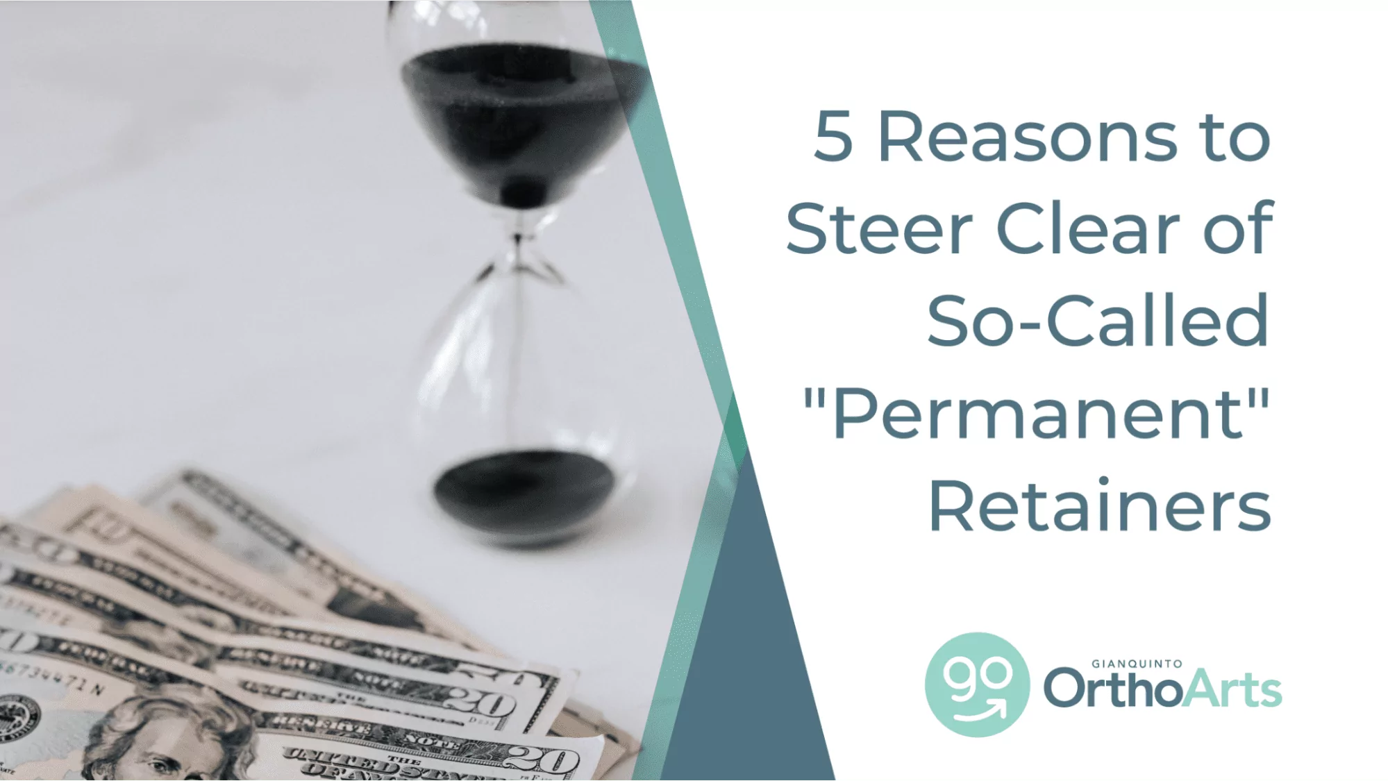 5 Reasons to Steer Clear of So-Called "Permanent" Retainers