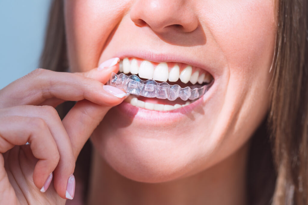 Close-up of a clear aligner held between fingers, showcasing its transparency and precision for Invisalign treatment in Bakersfield, CA