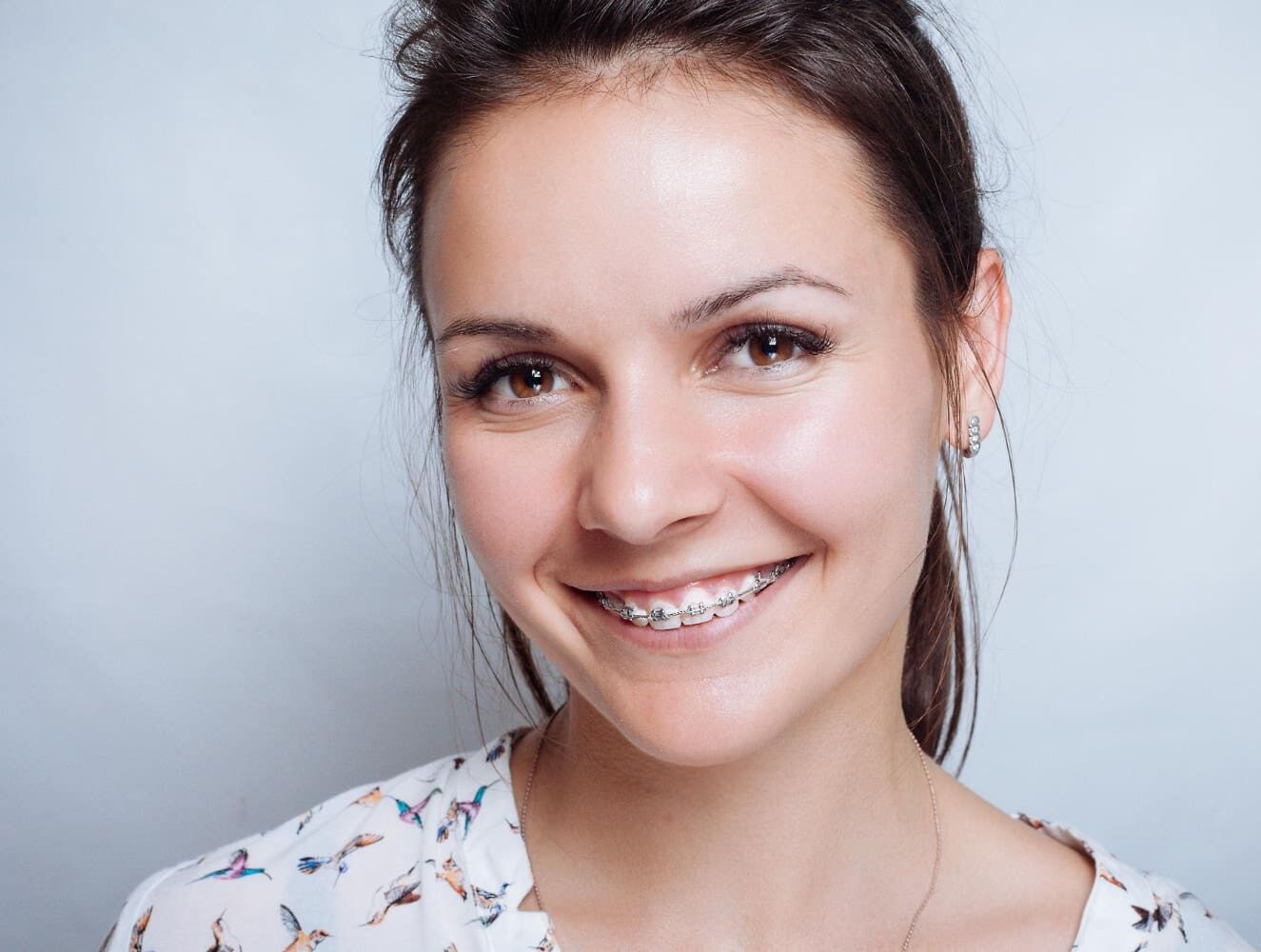 A young woman with metal braces smiles, wearing a butterfly top at Gianquinto Orthodontic Arts in Tehachapi, CA