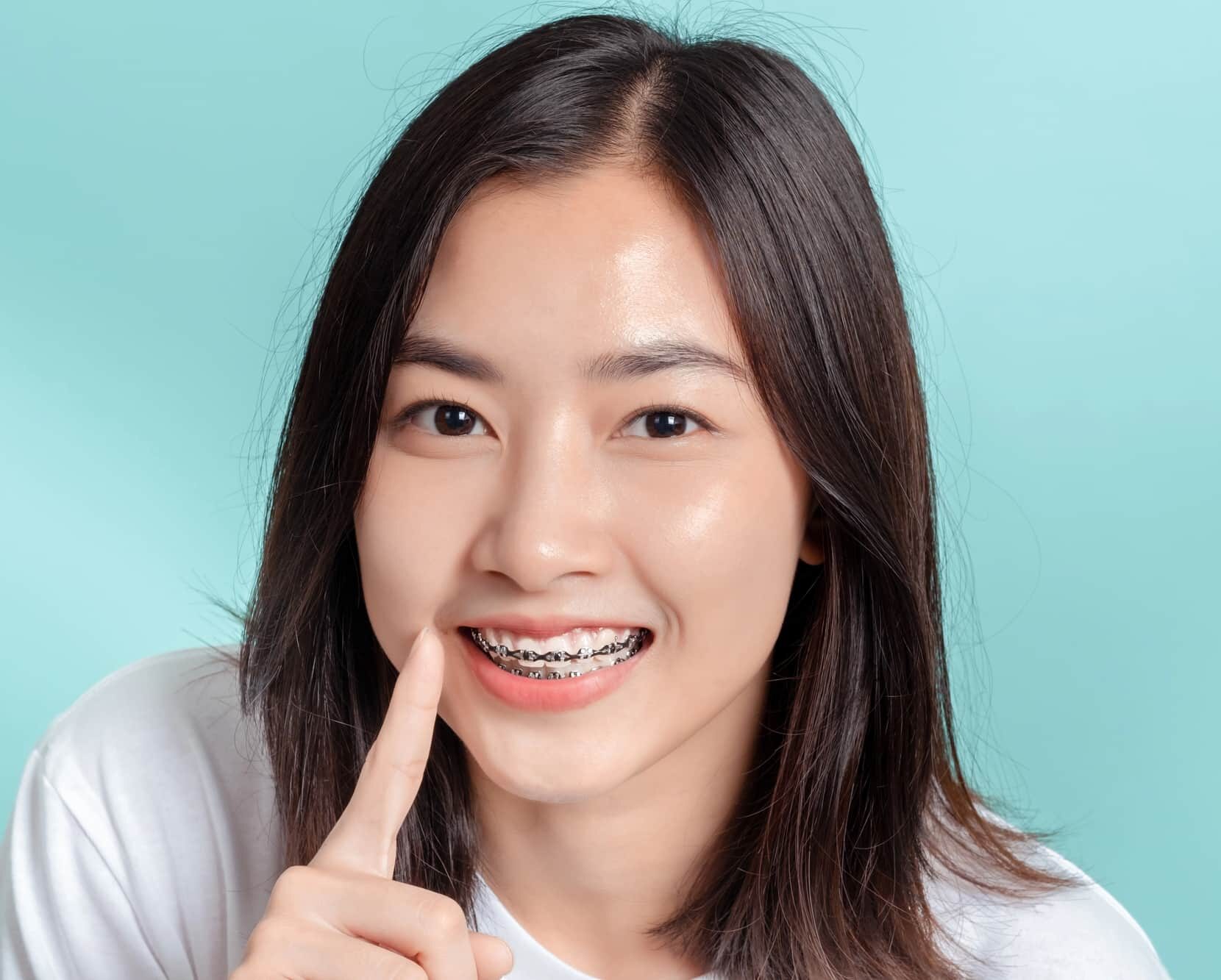 Aesthetic and Social Implications of Metal Braces from Gianquinto Orthodontic Arts in Bakersfield, Tehachapi or Mammoth Lakes, CA